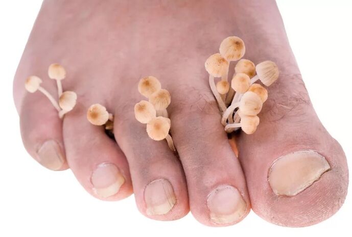 Foot mushroom