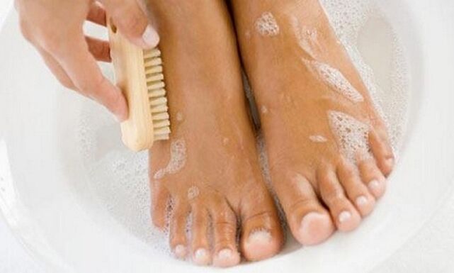 hygiene