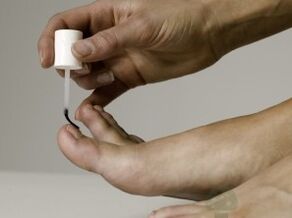 Healing nail fungus