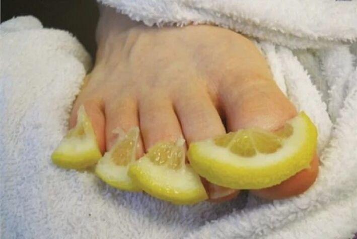 Poultices made of lemon drops - a folk remedy for toenail fungus
